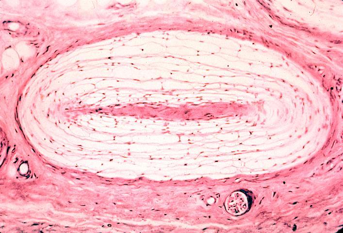 Epidermis Dermis Hipodermis Los receptores del tacto Vello 2 1 3 Terminaciones nerviosas La piel 4 a) Mecanorreceptores: sensibles a los cambios de presión.