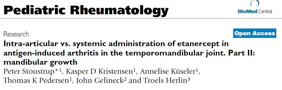 Tratamiento farmacológico AntiTNF Etanercept es eficaz en tto artritis ATM Comparación sc vs intraarticular: sc