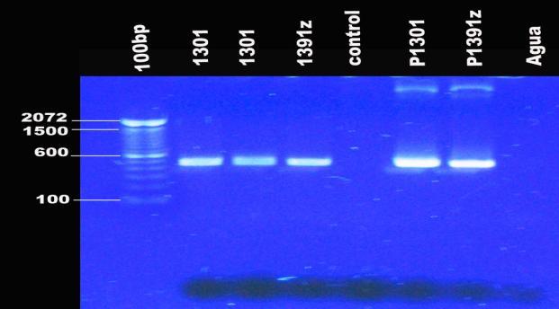 Estandarización del protocolo de transformación genética de células embriogénicas de banano de la variedad Williams (AAA) 109 Tabla 2. Actividad temporal del gen uida INT en el experimento AT2.