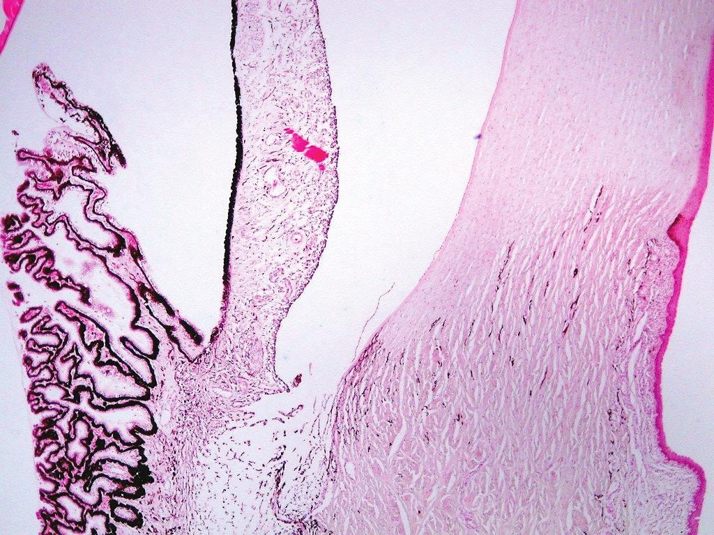 Introducción 301 melanocitos. La esclerótica es perforada por vasos sanguíneos, nervios y el nervio craneal II (nervio óptico) y se le conoce como lámina cribosa.
