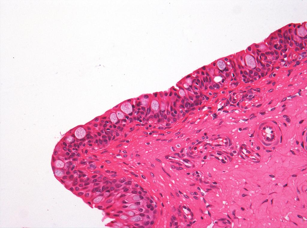 Existen otras glándulas lagrimales accesorias, mismas que se localizan en el párpado superior (de Wolfring) y en el fórnix del saco conjuntival (de Krause).