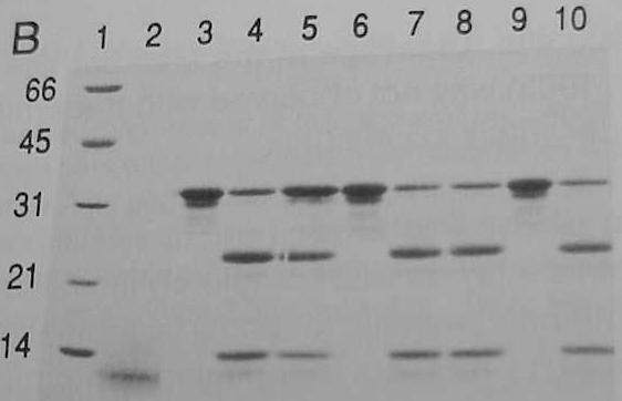 diferentes sustancias. Luego de la incubación se corrieron las muestras en un SDS-PAGE, que se tiñó con azul de Coomassie, un colorante que marca todas las proteínas presentes.