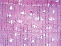 Hymenaea oblongifolia Huber Plano transversal 20X Plano tangencial 20X Plano radial 20X Descripción microscópica Poros / vasos Parénquima Longitudinal Solitarios, a veces múltiplos de 2, algunos con