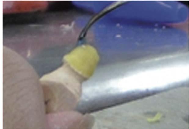 Usando el zirconio se pueden hacer estructuras sobre implantes fresados cementados y atornillados de hasta 14 piezas. Coronas y puentes de hasta 9 piezas.
