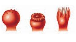 En la lengua, los botones gustativos se encuentran localizados en las papilas gustativas. Existen tres tipos de papilas: Papilas fungiformes. Papilas caliciformes.