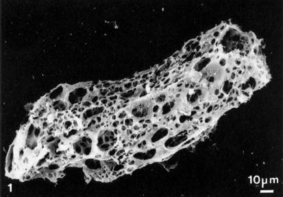 Micrografía de una partícula de