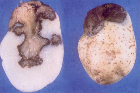 Pie negro (Erwinia sp) Pudrición seca (Fusarium spp.