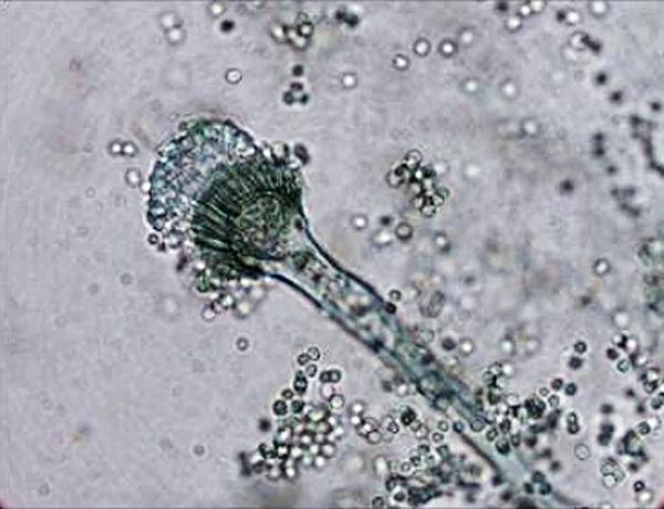 Figura 2. Observación microscópica de conidióforo y conidios de Aspergillus fumigatus (40x). Cuál es el agente etiológico del absceso epidural en este paciente?