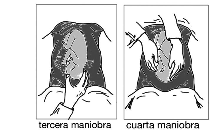 Tema 1: Atención a la mujer durante el parto presentación de hombro, se da en las situaciones oblicuas o transversas; el parto vaginal es imposible en partos a término.