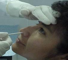 Muestra para el diagnóstico virológico: Aislamiento Viral Hisopado nasal y