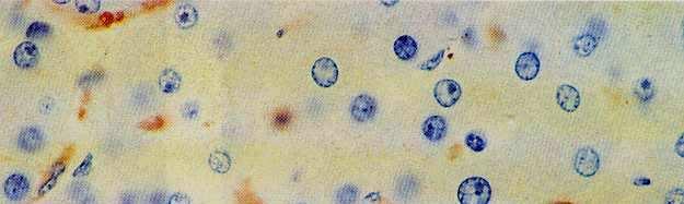 CÉLULAS DE KUPFFER Situadas en la superficie de las células endoteliales