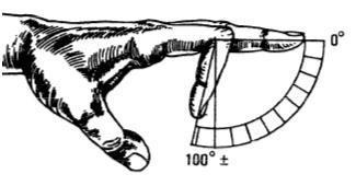 Durante la flexión normal de los dedos, éstos se encuentran juntos en movimiento continuo y tocan la palma aproximadamente al nivel del surco palmar distal como se muestran en las