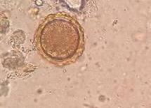 1.3.1. Parásitos considerados como patógenos 1.3.1.1. Ascaris lumbricoides Figura 1-1. Huevo de Ascaris lumbricoides Figura 2-1.