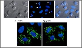 durante el desarrollo embrionario de Xenopus genus Normal Deficiente en apoptosis Características moleculares y celulares de la apoptosis Mantención de los niveles de ATP