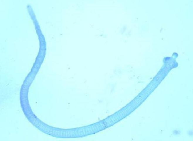 FIGURA 33. Adulto de Hymenolepis nana. Su tamaño es de 20x0.7mm.