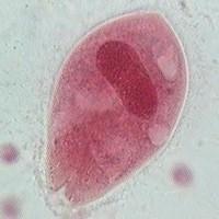 FIGURA 3. Balantidium coli.