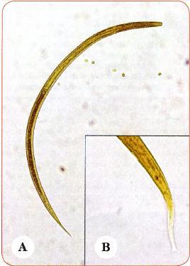 FIGURA 27. Strongyloides stercoralis. Al lado izquierdo Larva rhabditiforme en materia fecal.