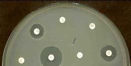 Test de Sensibilidad antimicrobiana Difusión en agar Método de Kirby Bauer Césped de bacteria