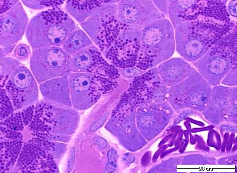 Retículo endoplásmico rugoso Denominado así por su aspecto debido a que presenta regiones tapizadas de ribosomas, donde se