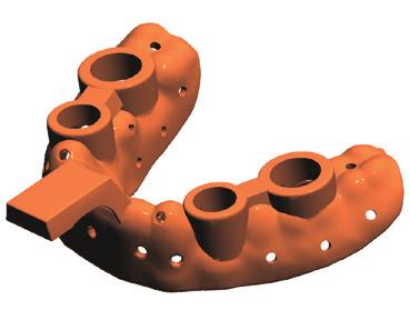 posible diseñar una prótesis compuesta de dos piezas que se pueden conectar fácilmente: una