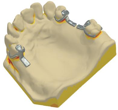 La opción se controla en la página Estructuras en el Control Panel de Dental System.