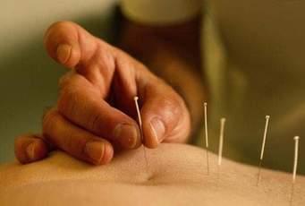 FORMACION EN ACUPUNTURA RACIONAL PARA OSTEOPATAS Presentamos una técnica de acupuntura muy fiable, de aplicación inmediata, y que permite al profesional osteópata un abordaje complementario en la
