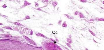 Hueso Cuando los osteoblastos quedan rodeadas por matriz, se tornan inactivas y