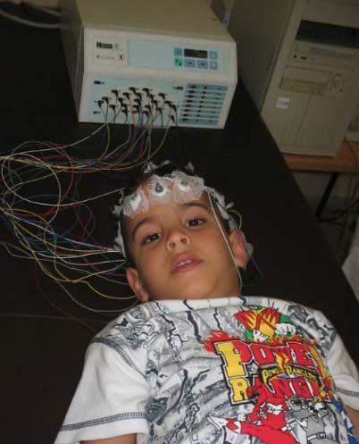 Programa Cubano para la Protección al Neurodesarrollo en la Etapa