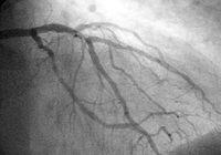 Tiempo Real La angiografía es un examen de diagnóstico por imagen cuya función es el estudio de los vasos circulatorios que no son visibles mediante la radiología convencional.