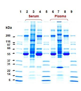 Suero 1-Marcador de peso molecular 2-Suero completo 3-Fraccción de proteínas minoritarias 4-Fracción de proteínas mayoritarias