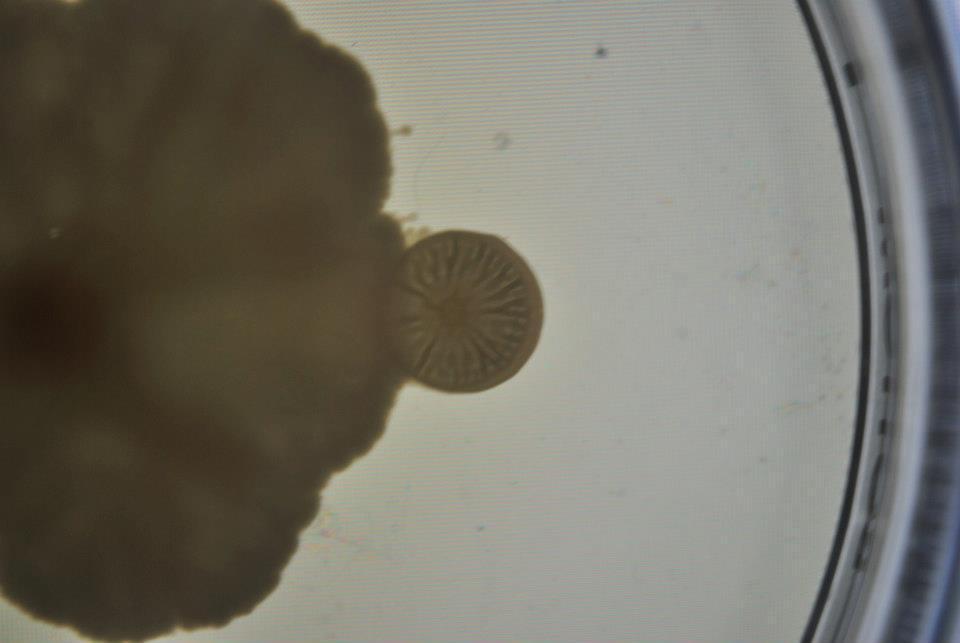 Fig.3 Morfología planoconvexa, irregular y ondulada con alta concentración de nutriente. Con 5 g de agar agar: Punto 1: Planoconvexa, rizoide (fig.