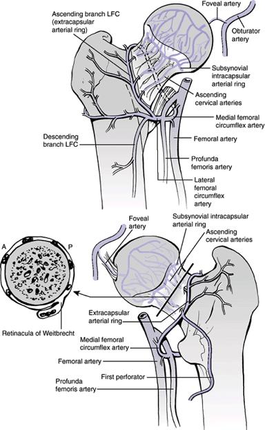 Figura 1. Vascularización de la cabeza femoral a través de las arterias metafisarias ascendentes y arteria del ligamento redondo.