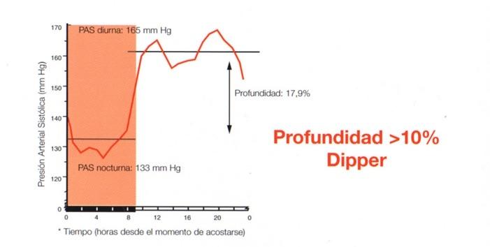 Estimación del ritmo circadiano de la PA Patrón Dipper Caída de la