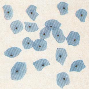 Capa Intermedia Células Intermedias: Varias filas de células basófilas, poliédricas, grandes, con núcleo vesiculoso y baja relación