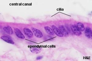 micro organismos y tejido nervioso dañado. Células ependimales.