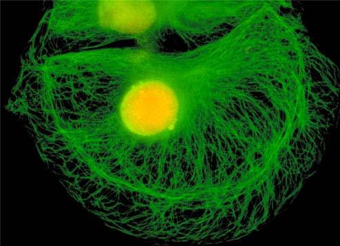 El citoesqueleto: Microtúbulos v