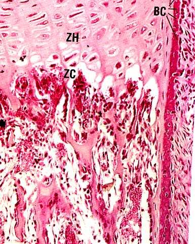 monedas). Cartílago hipertrofiado o maduro: células grandes, vacuoladas.