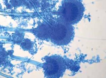 . Aspergillus flavus (azul de
