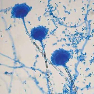 . Aspergillus terreus (azul de