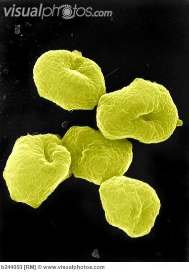 Orígenes y cromosomas en arqueas La velocidad de avance de las horquillas es intermedia entre bacterias y eucariontes: unas 10 veces más veloz que en Eukarya.