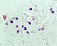 MICROSPORIDIOS Los microsporidios son protozoos intracelulares obligados que pertenecen al filo Microspora. Hasta la fecha se han descrito más de 1.