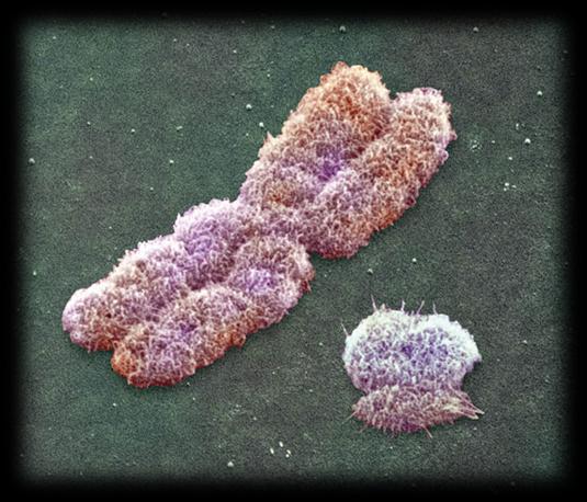Frecuencia de Anomalías cromosómicas GMSI