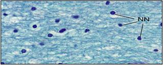 Las células granulosas (GC) también son abundantes aunque difíciles de identificar.