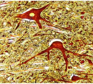 Las fibras aferentes establecen sinapsis con las neuronas granulosas en las regiones pálidas llamadas glomérulos (flechas).