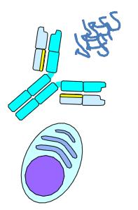AMILOIDOSIS AL Acumulación de cadenas monoclonales ligeras libres o sus fragmentos como fibrillas amiloides extracelulares insolubles que se depositan en distintos órganos causándoles daños
