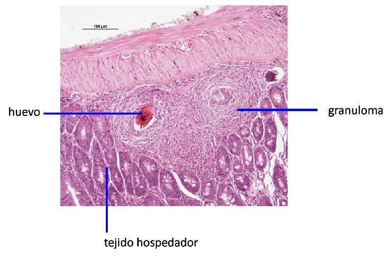 Granulomas Corte histológico de granuloma en intestino de ratón (Fig. 28). Figura 28. Fotografía de un corte histológico mostrando un granuloma alrededor de un huevo de Schistosoma sp.