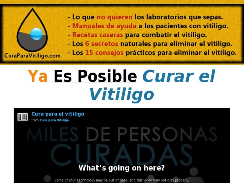 > GET IT HERE < SOME TAGS: Cura para el vitiligo en colombia, best price cura para el vitiligo y cã³mo crearla desde casa real user experience; que remedio casero sirve para el vitiligo, cura para el