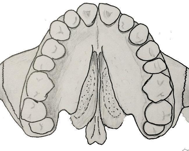 24 nariz y la arcada dental, y pueden llegar hasta el agujero incisivo (Sadler, Cabeza y cuello, 2012).