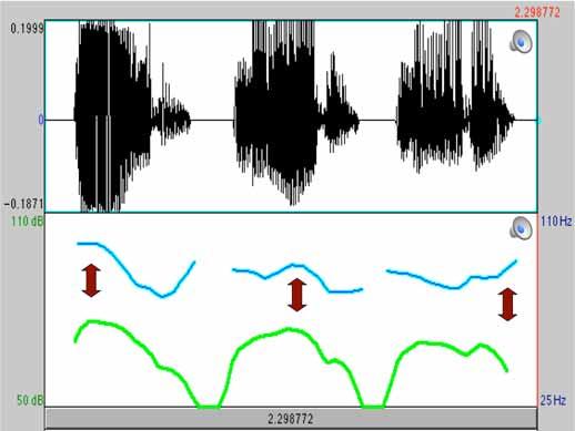 La melodía Los elementos suprasegmentales Frecuencia de vibración de las cuerdas vocales Tonos graves Tiempo Tonos agudos Frecuencia fundamental El acento