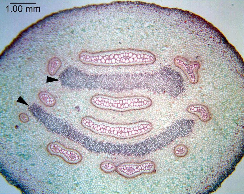 Polypodiales: Anatomía del tallo (rizoma) Dictiostela: sifonostela